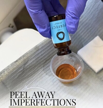 Peel away imperfections photo